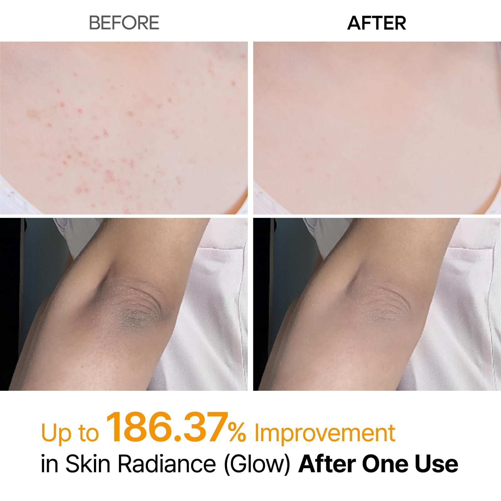 Dr. Melaxin Body Keratin Care 2