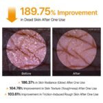 Dr. Melaxin Body Keratin Care