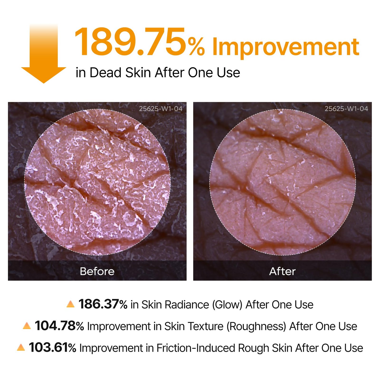 Dr. Melaxin Body Keratin Care 5